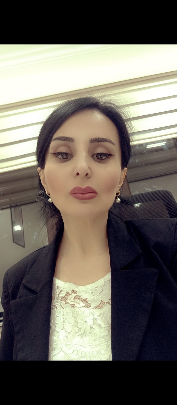 Lale Axmedova